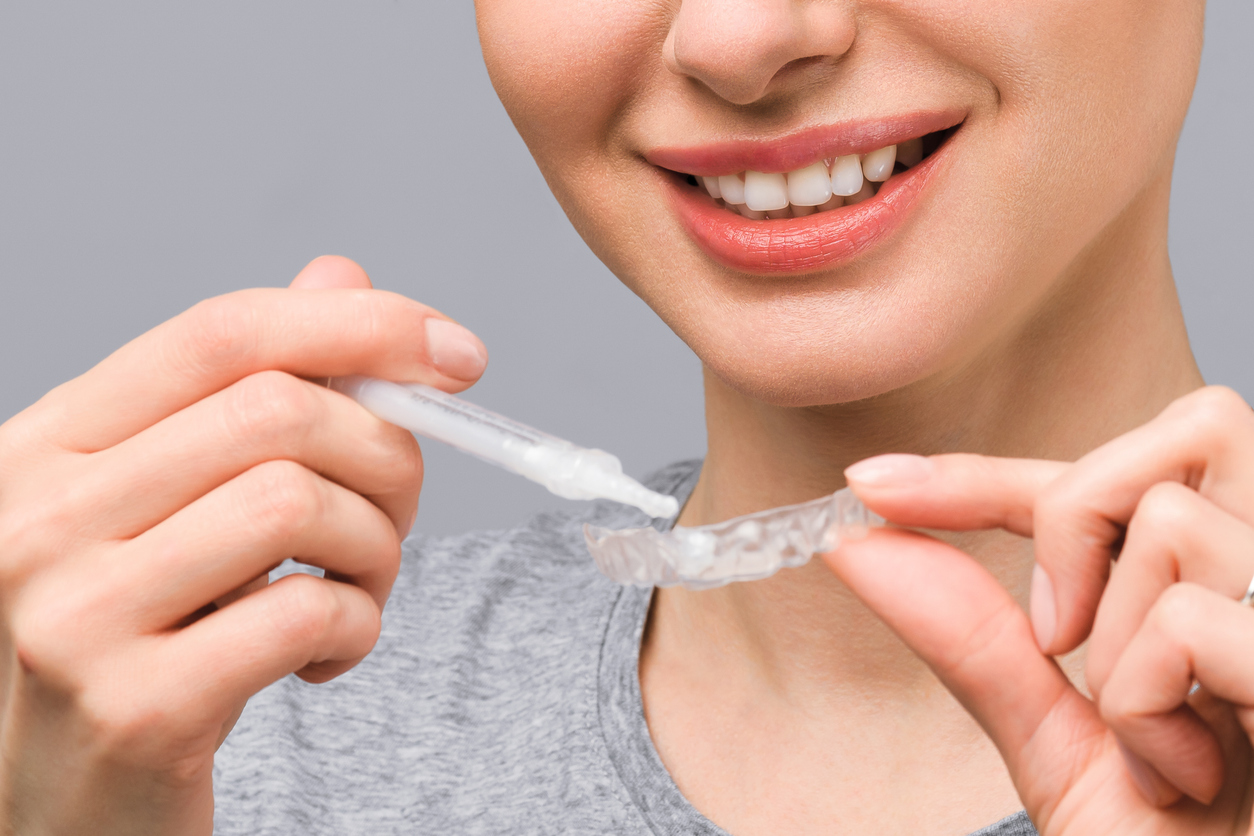 A young woman does a home teeth whitening procedure. Whitening tray with gel A young woman does a home teeth whitening procedure. Whitening tray with gel.